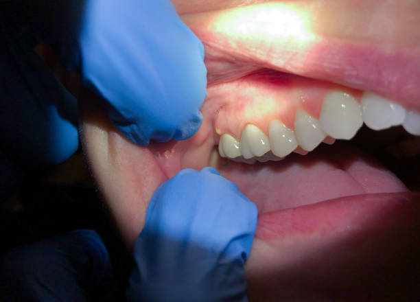 Best Broken Tooth Emergency  in Hitchcock, TX