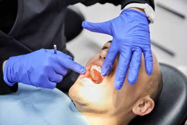 Best Emergency Tooth Extraction  in Hitchcock, TX